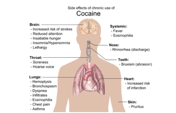 COCAINE What are the risks  toxicity.webp