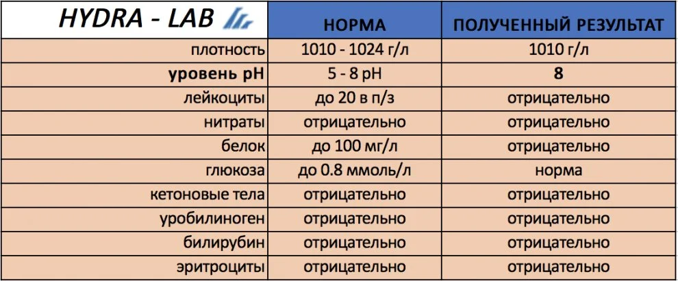 ОБЩИЙ АНАЛИЗ МОЧИ.webp
